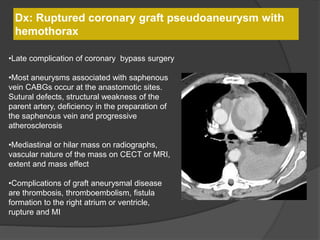Dx: Ruptured coronary graft pseudoaneurysm with
hemothorax
•Late complication of coronary bypass surgery
•Most aneurysms associated with saphenous
vein CABGs occur at the anastomotic sites.
Sutural defects, structural weakness of the
parent artery, deficiency in the preparation of
the saphenous vein and progressive
atherosclerosis
•Mediastinal or hilar mass on radiographs,
vascular nature of the mass on CECT or MRI,
extent and mass effect
•Complications of graft aneurysmal disease
are thrombosis, thromboembolism, fistula
formation to the right atrium or ventricle,
rupture and MI
 