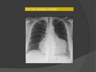 38-F with shortness of breath
 
