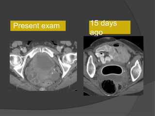 15 days
ago
Present exam
 