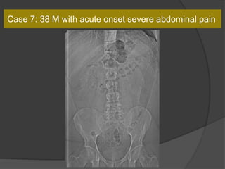 Case 7: 38 M with acute onset severe abdominal pain
 