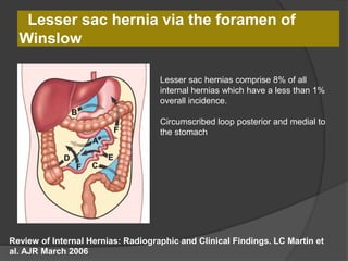 Lesser sac hernia via the foramen of
Winslow
Review of Internal Hernias: Radiographic and Clinical Findings. LC Martin et
al. AJR March 2006
Lesser sac hernias comprise 8% of all
internal hernias which have a less than 1%
overall incidence.
Circumscribed loop posterior and medial to
the stomach
 