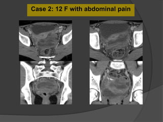 Case 2: 12 F with abdominal pain
 