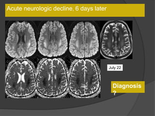 Acute neurologic decline, 6 days later
July 22
Diagnosis
?
 