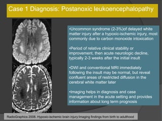 Case 1 Diagnosis: Postanoxic leukoencephalopathy
•Uncommon syndrome (2-3%)of delayed white
matter injury after a hypoxic-ischemic injury, most
commonly due to carbon monoxide intoxication
•Period of relative clinical stability or
improvement, then acute neurologic decline,
typically 2-3 weeks after the initial insult
•DWI and conventional MRI immediately
following the insult may be normal, but reveal
confluent areas of restricted diffusion in the
cerebral white matter later
•Imaging helps in diagnosis and case
management in the acute setting and provides
information about long term prognosis
RadioGraphics 2008. Hypoxic-ischemic brain injury:Imaging findings from birth to adulthood
 