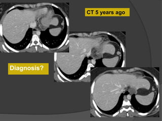 CT 5 years ago
Diagnosis?
 