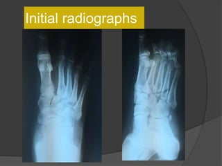 Initial radiographs
 