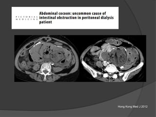 Hong Kong Med J 2012
 