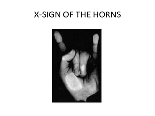 X-SIGN OF THE HORNS