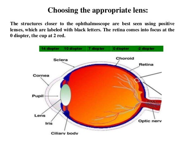 Ophthalmoscopy