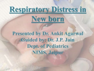Respiratory Distress in
New born
Presented by Dr. Ankit Agarwal
Guided by: Dr. J.P. Jain
Dept. of Pediatrics
NIMS, Jaipur
 