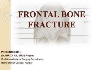FRONTAL BONE
FRACTURE
PRESENTED BY –
Dr.ANKITA RAJ (MDS Reader)
Oral & Maxillofacial Surgery Department
Rama Dental College, Kanpur
 