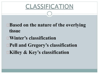 Based on the nature of the overlying
tissue
Winter’s classification
Pell and Gregory’s classification
Killey & Key’s classification
 