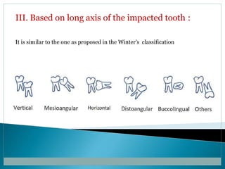 III. Based on long axis of the impacted tooth :
It is similar to the one as proposed in the Winter’s classification
 
