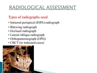 Types of radiographs used
• Intraoral periapical (IOPA) radiograph
• Bitewing radiograph
• Occlusal radiograph
• Lateral oblique radiograph
• Orthopantomograph (OPG)
• CBCT (in indicated cases)
 