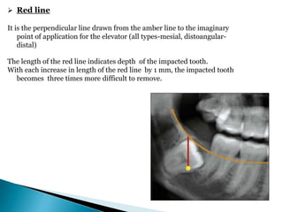 Red line
It is the perpendicular line drawn from the amber line to the imaginary
point of application for the elevator (all types-mesial, distoangular-
distal)
The length of the red line indicates depth of the impacted tooth.
With each increase in length of the red line by 1 mm, the impacted tooth
becomes three times more difficult to remove.
 
