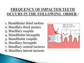 1. Mandibular third molars
2. Maxillary third molars
3. Maxillary cuspids
4. Mandibular bicuspids
5. Mandibular cuspids
6. Maxillary bicuspids
7. Maxillary central incisors
8. Maxillary lateral incisors
 