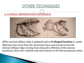 A. LATERAL TREPHINATION TECHNIQUE
The external oblique ridge is palpated and an S-shaped incision is made.
Incision line starts from the retromolar fossa and extends across the
external oblique ridge curving down along the reflection of the mucous
membrane above the vestibule and ends anterior to the first permanent molar.
 