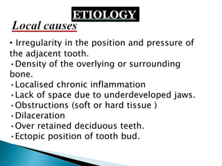 ETIOLOGY
• Irregularity in the position and pressure of
the adjacent tooth.
•Density of the overlying or surrounding
bone.
•Localised chronic inflammation
•Lack of space due to underdeveloped jaws.
•Obstructions (soft or hard tissue )
•Dilaceration
•Over retained deciduous teeth.
•Ectopic position of tooth bud.
 