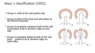 Veau Classfication A brief description of anatomy , classification and surgeries in cleft ...