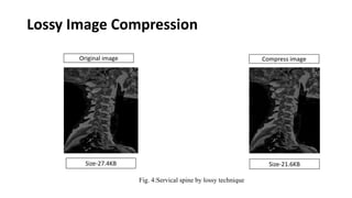 Medical Image Compression with security & water marking | PPTX