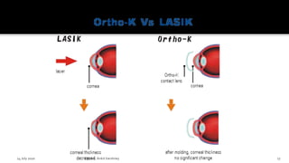 14 July 2020 Optom.AnkitVarshney 17
 