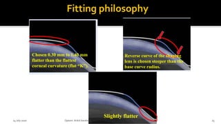 Chosen 0.30 mm to 1.40 mm
flatter than the flattest
corneal curvature (flat “K”).
Reverse curve of the shaping
lens is chosen steeper than the
base curve radius.
Slightly flatter
14 July 2020 Optom.AnkitVarshney 25
 