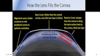 14 July 2020 Optom.AnkitVarshney 26
 