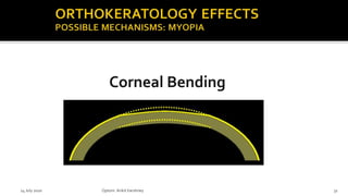 14 July 2020 Optom.AnkitVarshney 31
 