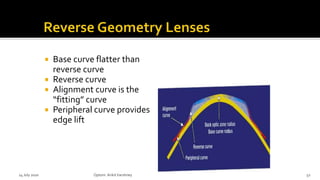  Base curve flatter than
reverse curve
 Reverse curve
 Alignment curve is the
“fitting” curve
 Peripheral curve provides
edge lift
14 July 2020 Optom.AnkitVarshney 52
 