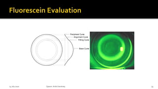Peripheral Curve
Alignment Curve
Fitting Curve
Base Curve
14 July 2020 Optom.AnkitVarshney 55
 