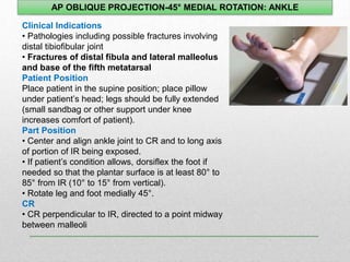 ankle.ppt