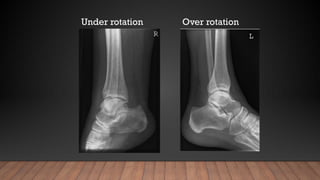 ANKLE radiographic procedure and positioning .pptx