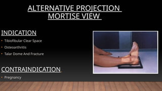 ANKLE radiographic procedure and positioning .pptx