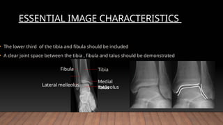 ANKLE radiographic procedure and positioning .pptx
