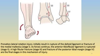 Ankle and foot assessment for physiotherapy | PPTX
