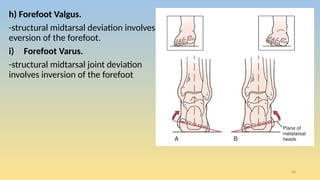 Varus Foot Rotation Ankle and foot assessment for physiotherapy | PPTX