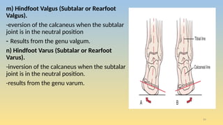 Varus Rear Foot Post Ankle and foot assessment for physiotherapy | PPTX