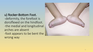 Ankle and foot assessment for physiotherapy | PPTX