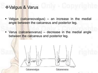 Valgus & Varus
 Valgus (calcaneovalgus) – an increase in the medial
angle between the calcaneus and posterior leg.
 Varus (calcaneovarus) – decrease in the medial angle
between the calcaneus and posterior leg.
 