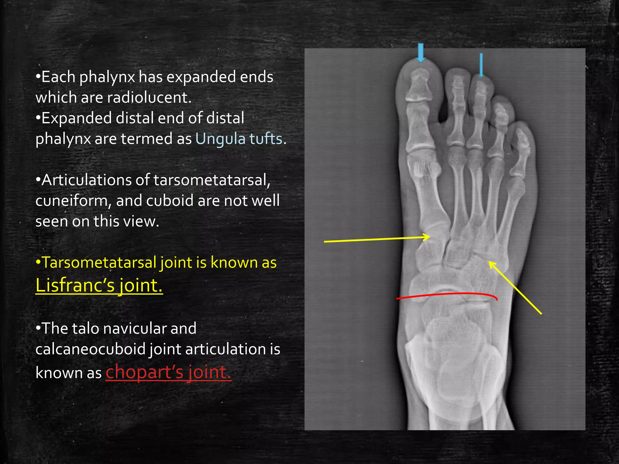 Normal Ankle and foot Radiographs by Dr Avinash | PPTX