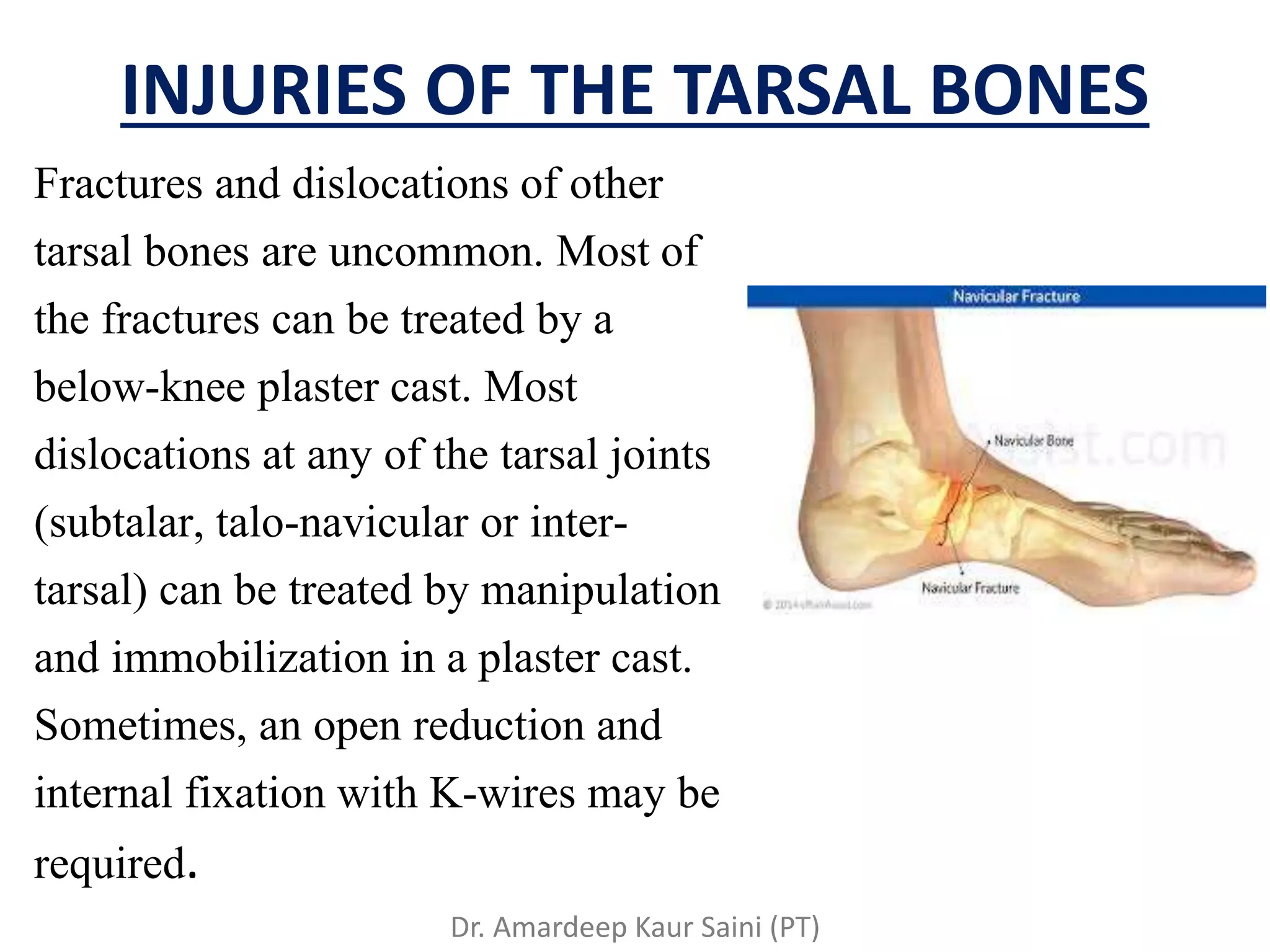 Tar Injury Ankle and foot injuries | PPTX