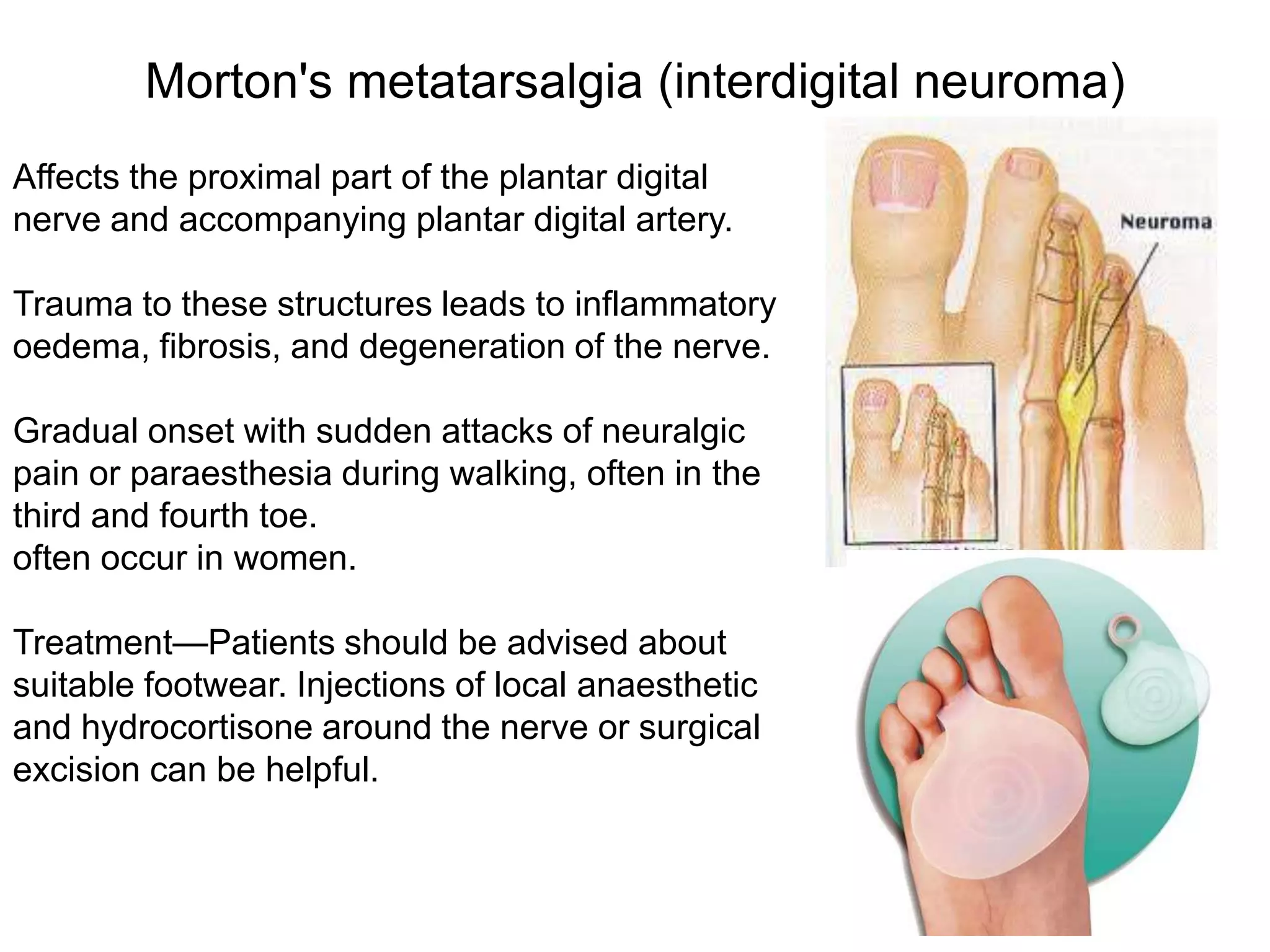 Ankle and foot pain | PPTX