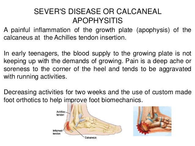 Ankle and foot pain