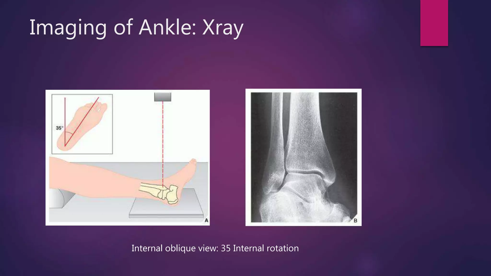 Ankle and Foot | PPTX