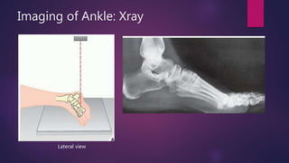 Ankle and Foot | PPTX