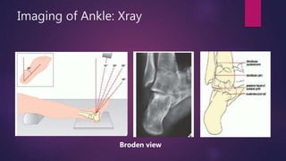 Ankle and Foot | PPTX