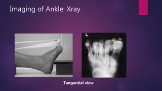 Ankle and Foot | PPTX