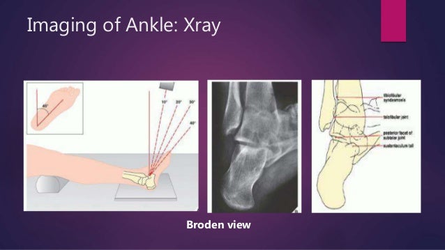 Ankle and Foot