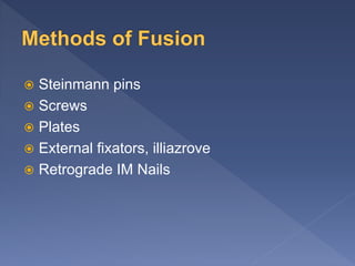  Steinmann pins
 Screws
 Plates
 External fixators, illiazrove
 Retrograde IM Nails
 