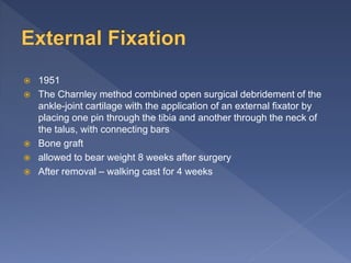  1951
 The Charnley method combined open surgical debridement of the
ankle-joint cartilage with the application of an external fixator by
placing one pin through the tibia and another through the neck of
the talus, with connecting bars
 Bone graft
 allowed to bear weight 8 weeks after surgery
 After removal – walking cast for 4 weeks
 